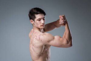 Natural Bodybuilding vs Steroid