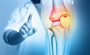 6 Gentle Exercises to Strengthen Your Joints and Avoid Injury