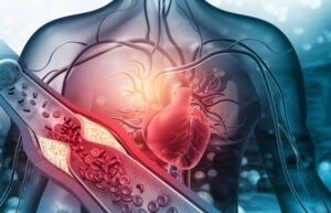 angioplasty Rakesh Roshan