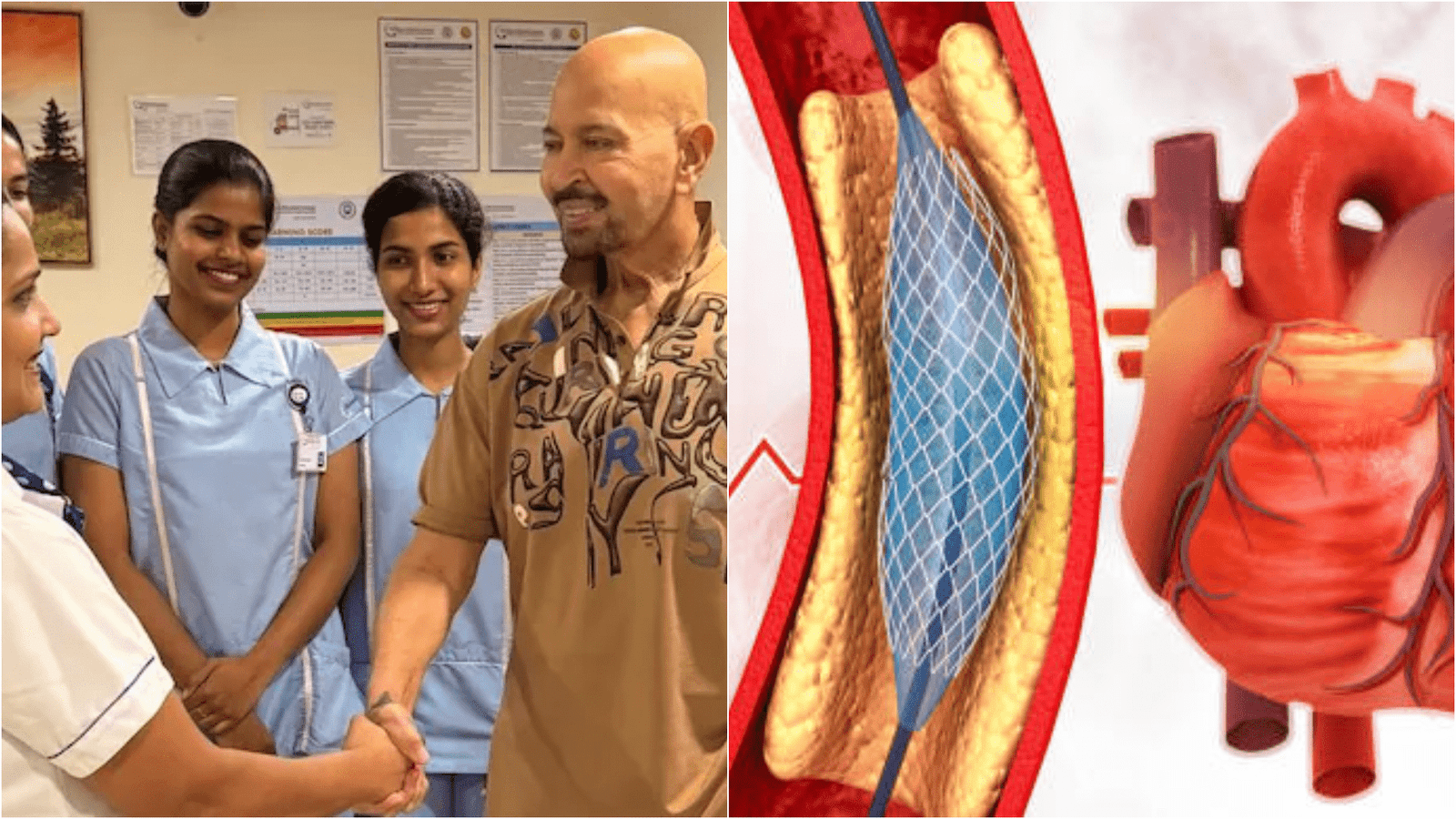 angioplasty Rakesh Roshan