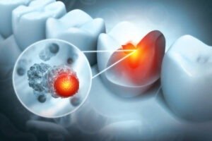 Oral Health and Overall Health