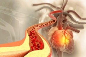 ज्यादा नमक