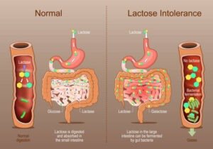 lactose intolerance symptoms in hindi