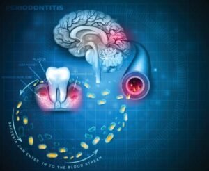 Oral Health and Overall Health