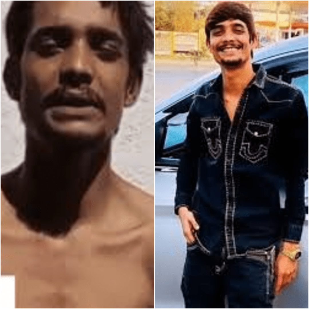 इंदौर के कुख्यात गैंगस्टर सलमान लाला की मौत