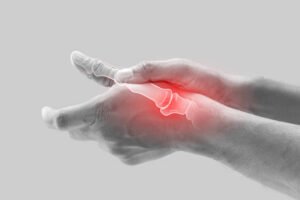 Arthritis Symptoms