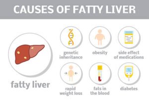 Fatty Lever Symptoms in Hindi