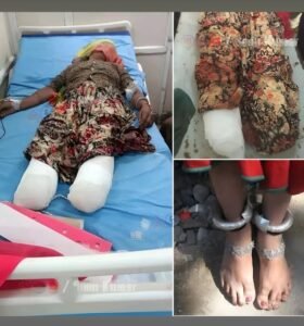 1.5 किलो चांदी के लिए औरत के पैर काट डाले